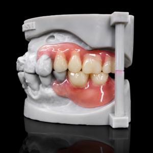 Flexible Partial Denture