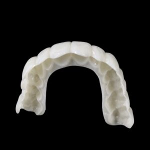 Custom Made Snap On Veneers