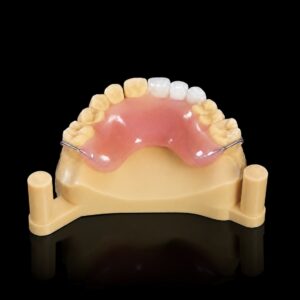 Acrylic Partial Denture Flipper