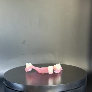 Flexible Partial Denture