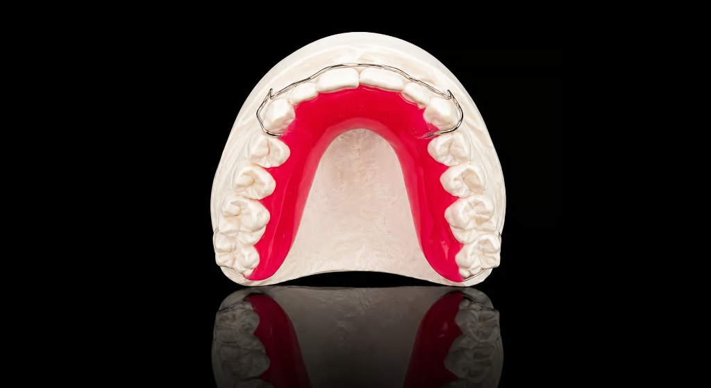 Hawley orthodontic retainer with pink acrylic and labial wire on dental model
