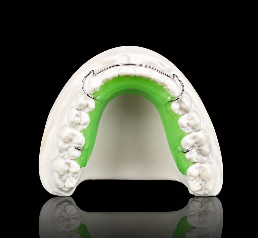Custom Hawley retainer with green acrylic palate and wire on dental model