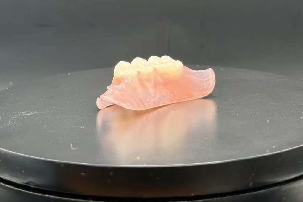 Flexible gum-colored resin Nesbit partial denture