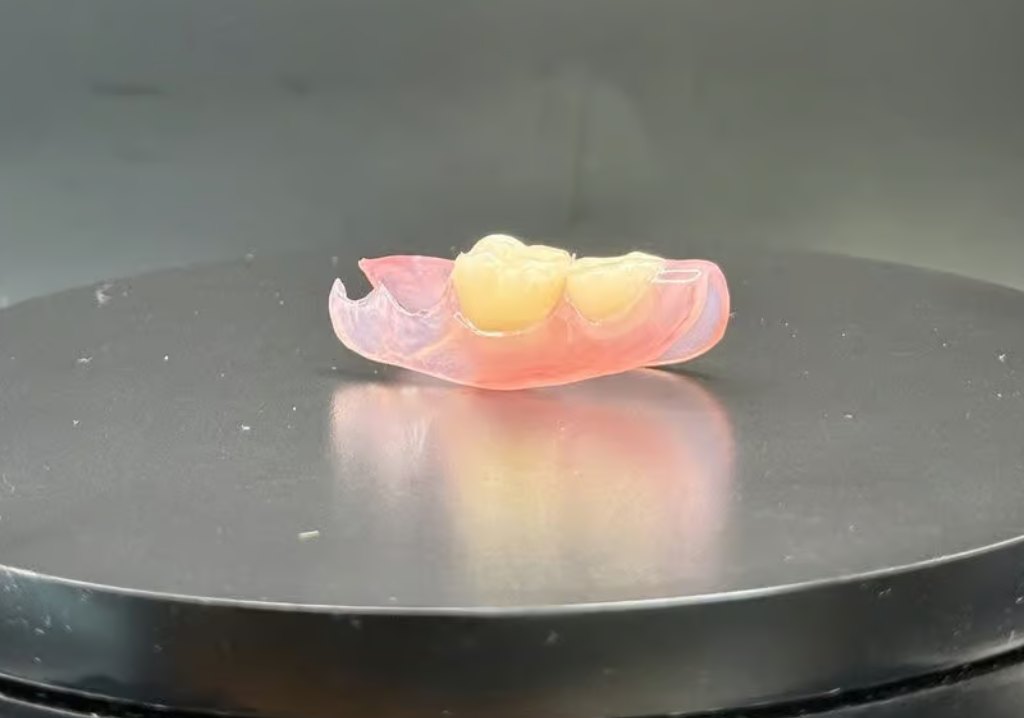 Nesbit flexible partial denture replacing back teeth