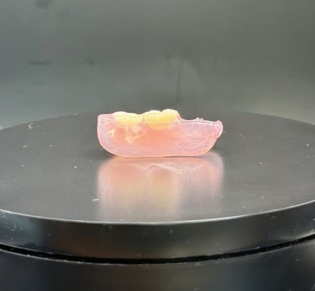 Metal-free Nesbit flexible partial denture